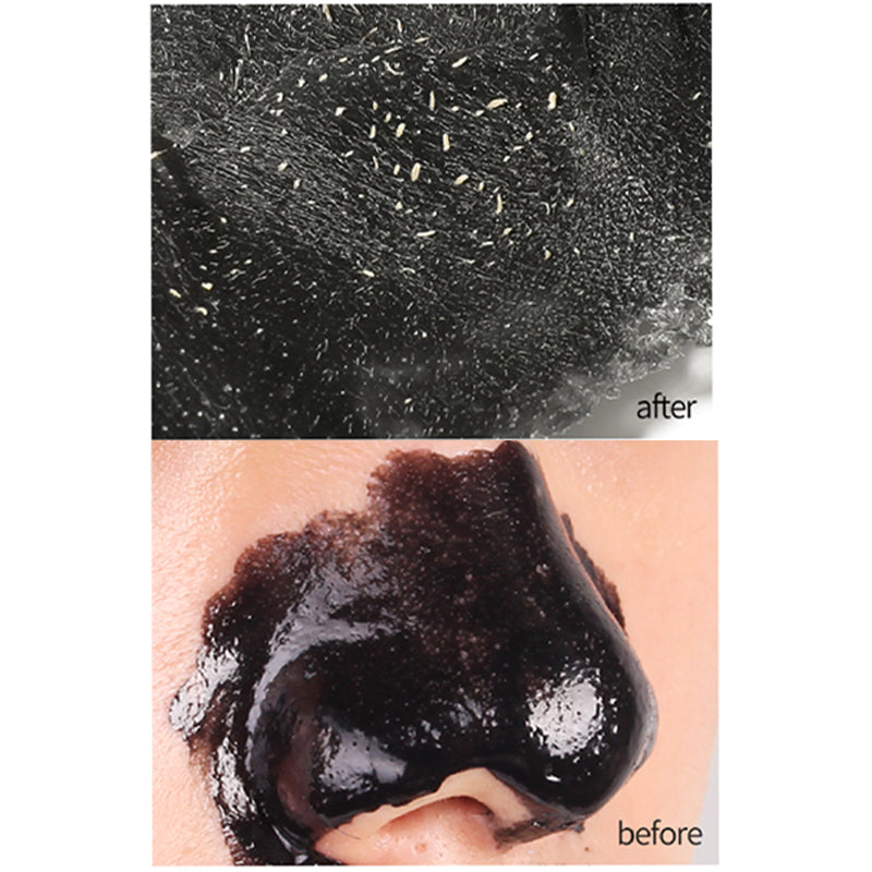 Gel Extractor De Puntos Negros Takopore