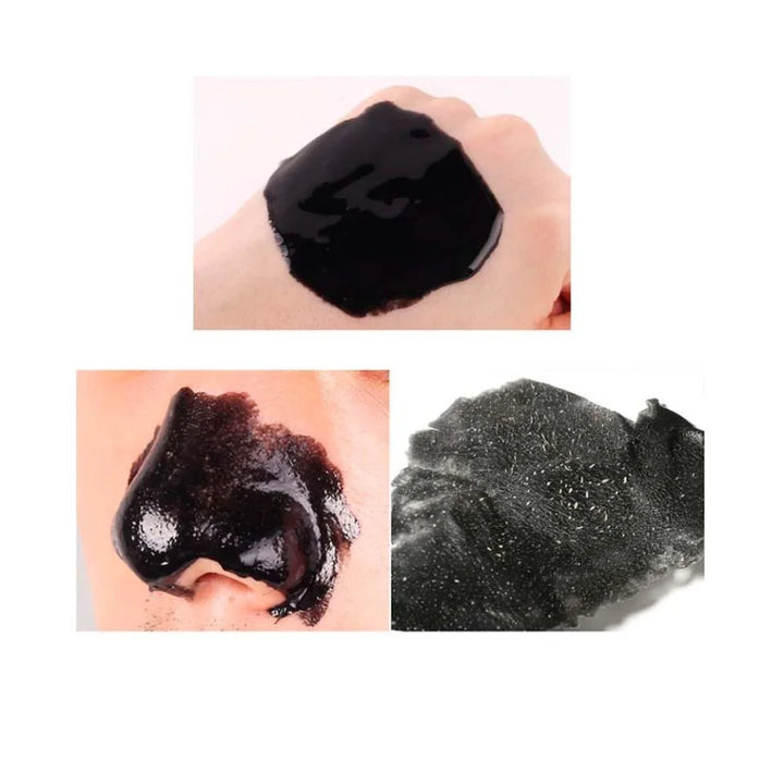 Gel Extractor De Puntos Negros Takopore