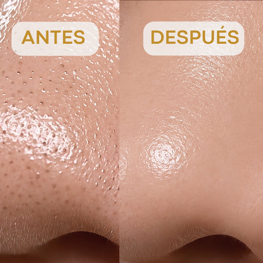 Parche de nariz para puntos negros caja con 7 pzas - Egg Pore