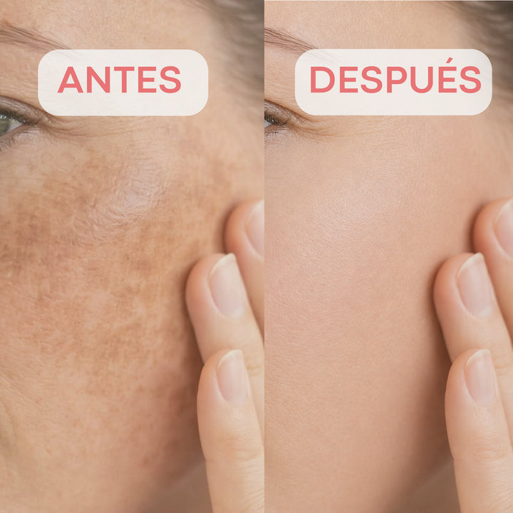 Pack Anti manchas Tomatox + Panda